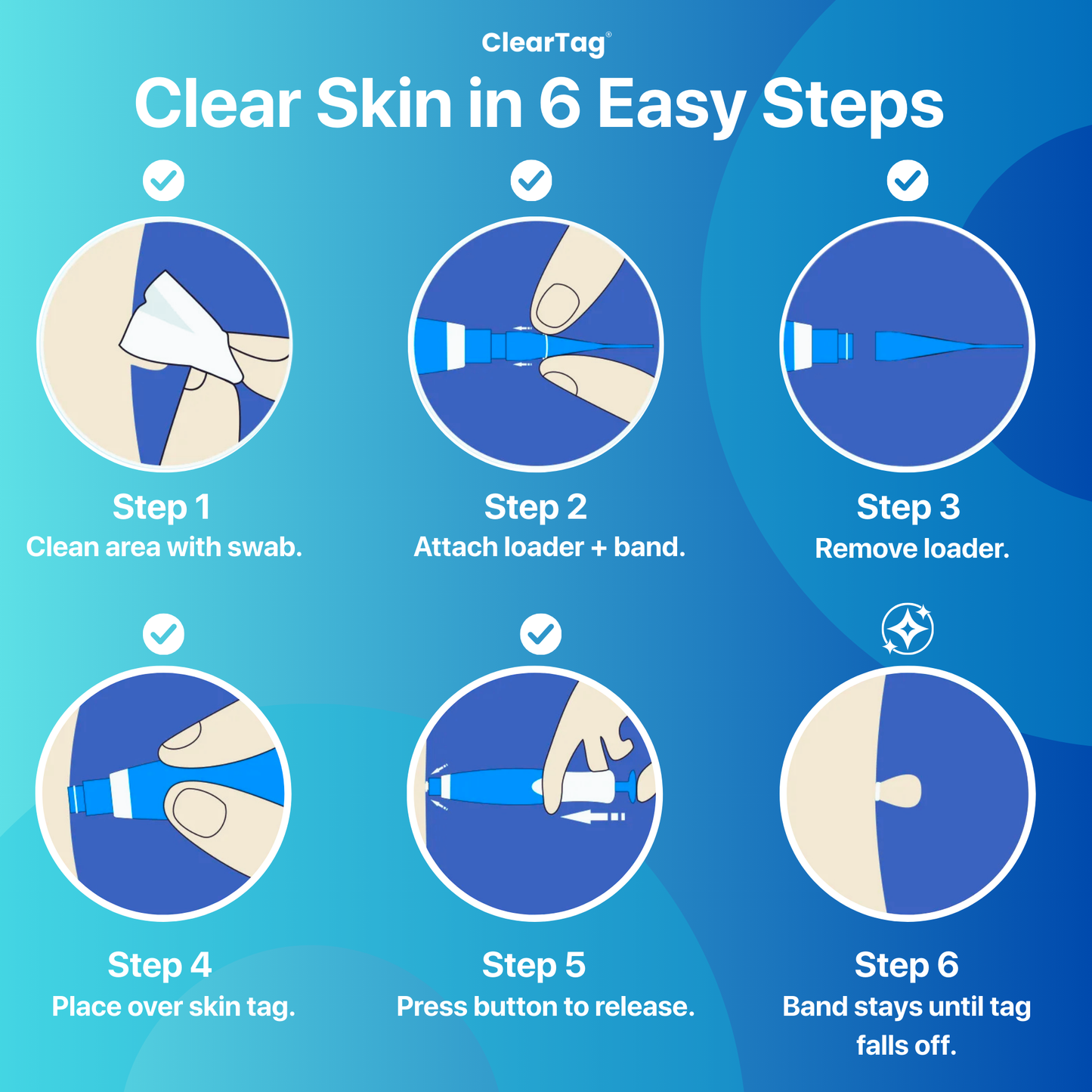 ClearTag skin tag removal kit – instructions in 6 easy steps
